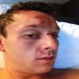Sam Trickett Attacked, Beaten Following “One Drop” Final Table Thumbnail