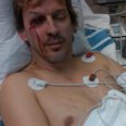 Phil Laak Injured, Hospitalized in ATV Accident Thumbnail